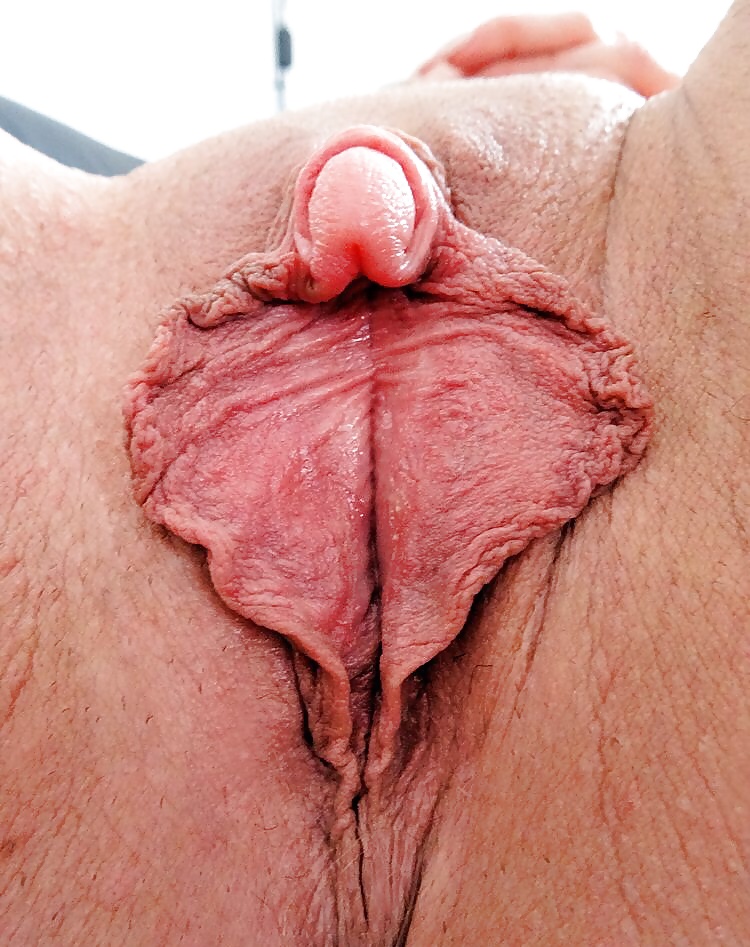 Worlds largest clitoris picture