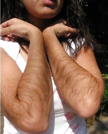 Hairy mexican arms