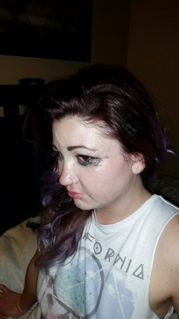 Sammie Louisburg facial after rough use