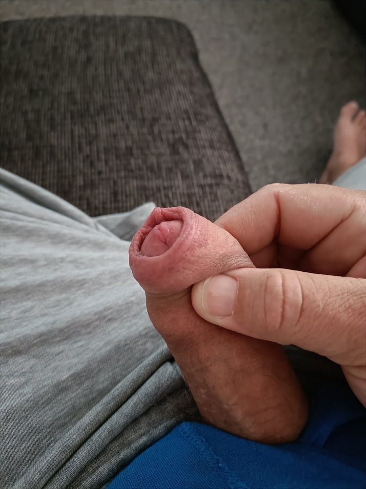 Soft Dick And Foreskin 35 Pics Xhamster