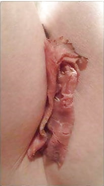 Porn Pics herma et clito 'enorme