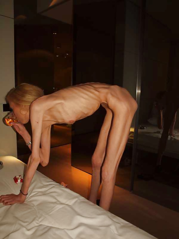 Porn Pics Anorexic ultra skinny 3