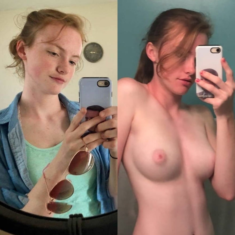 Before and After - Selfie 14 - 20 Pics 