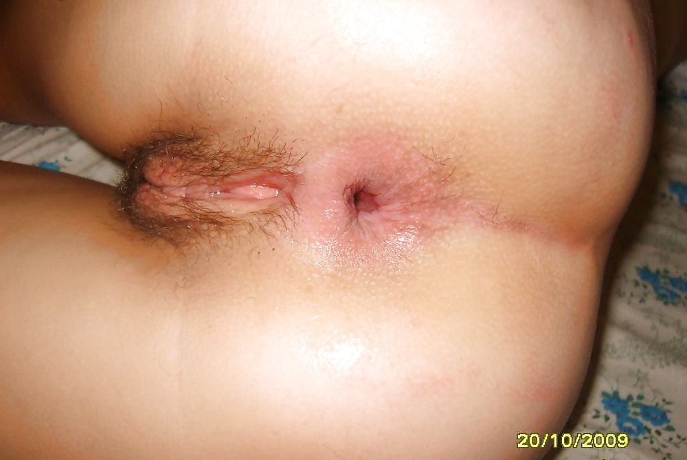 Porn Pics 2 Fetish Freaks