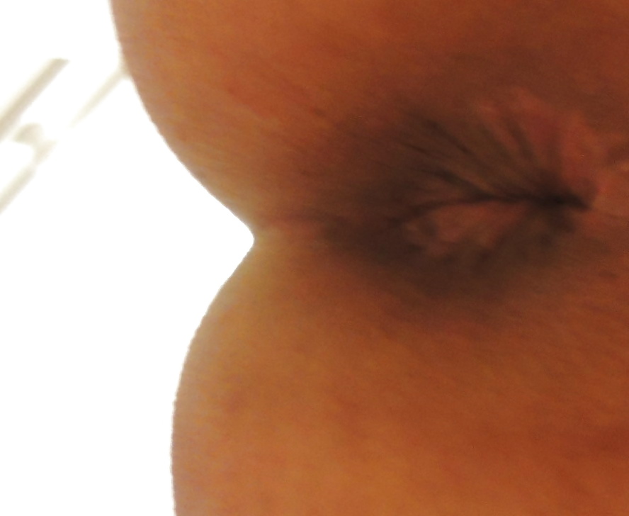 Porn Pics My butthole as 19 years old