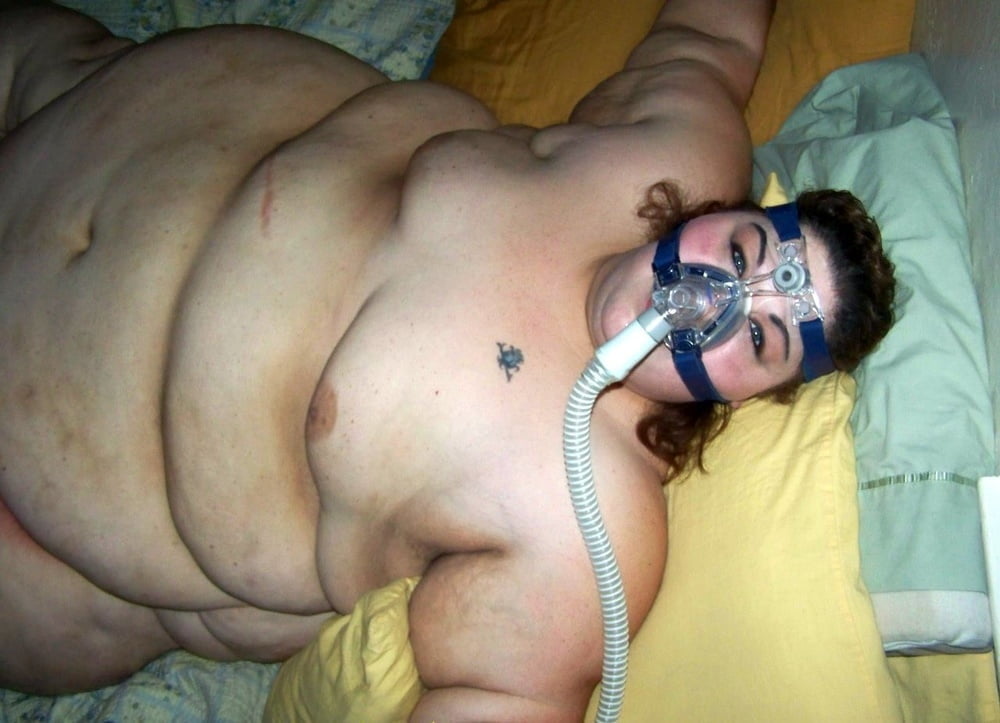 SSBBW With Breathing Or Mobility Apparatus - 15 Photos 