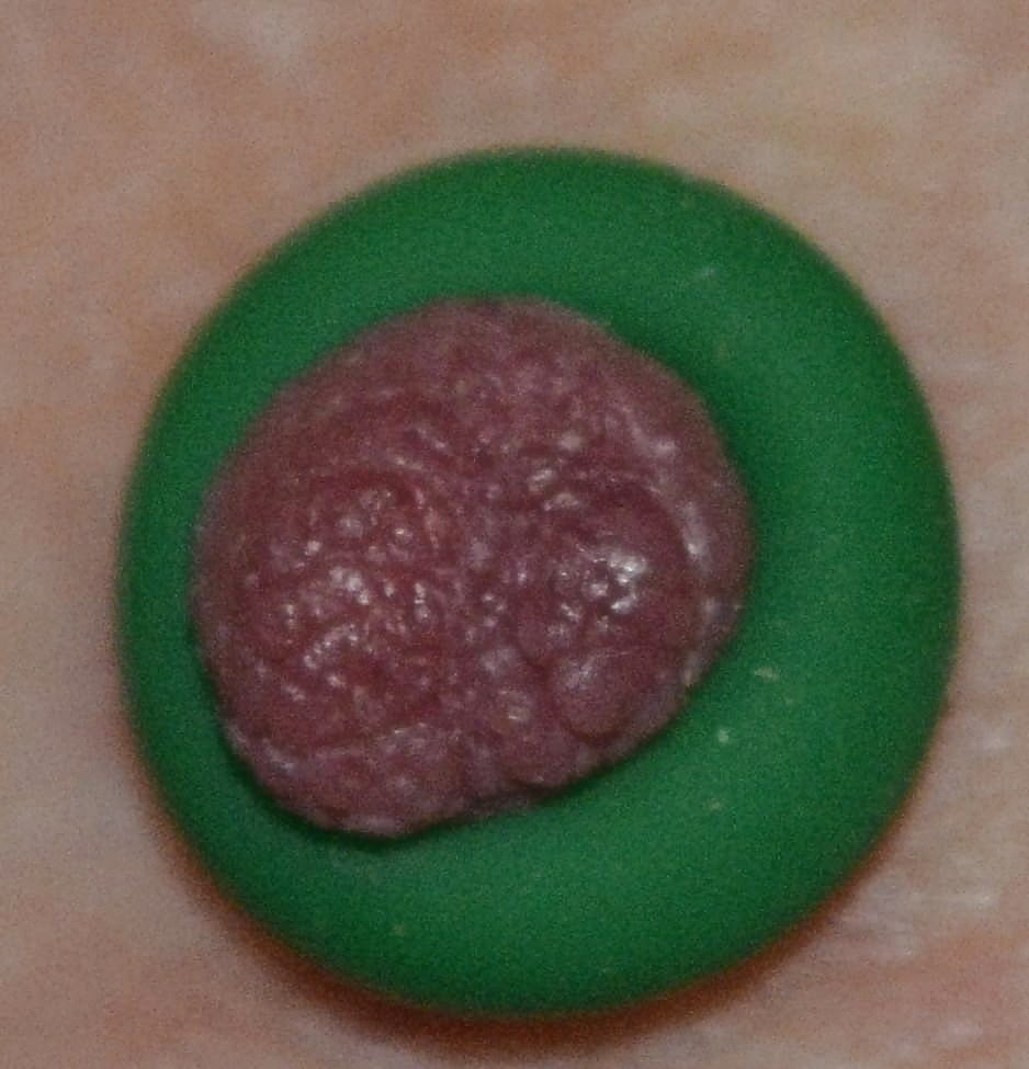 Porn Pics 10-Mar-2016 Testing an Elastrator