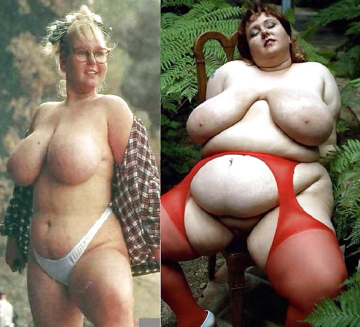 Weight Gain Before After - Free XXX Pics, Best Sex Images and Hot Porn  Photos on www.slashporn.net