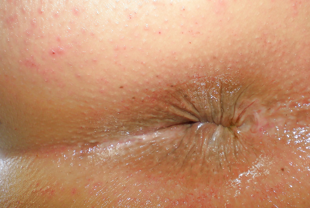 Porn Pics My girlie butthole as 18 years and 2 month old