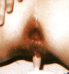 Porn Pics Anal Pics Close-Up By X