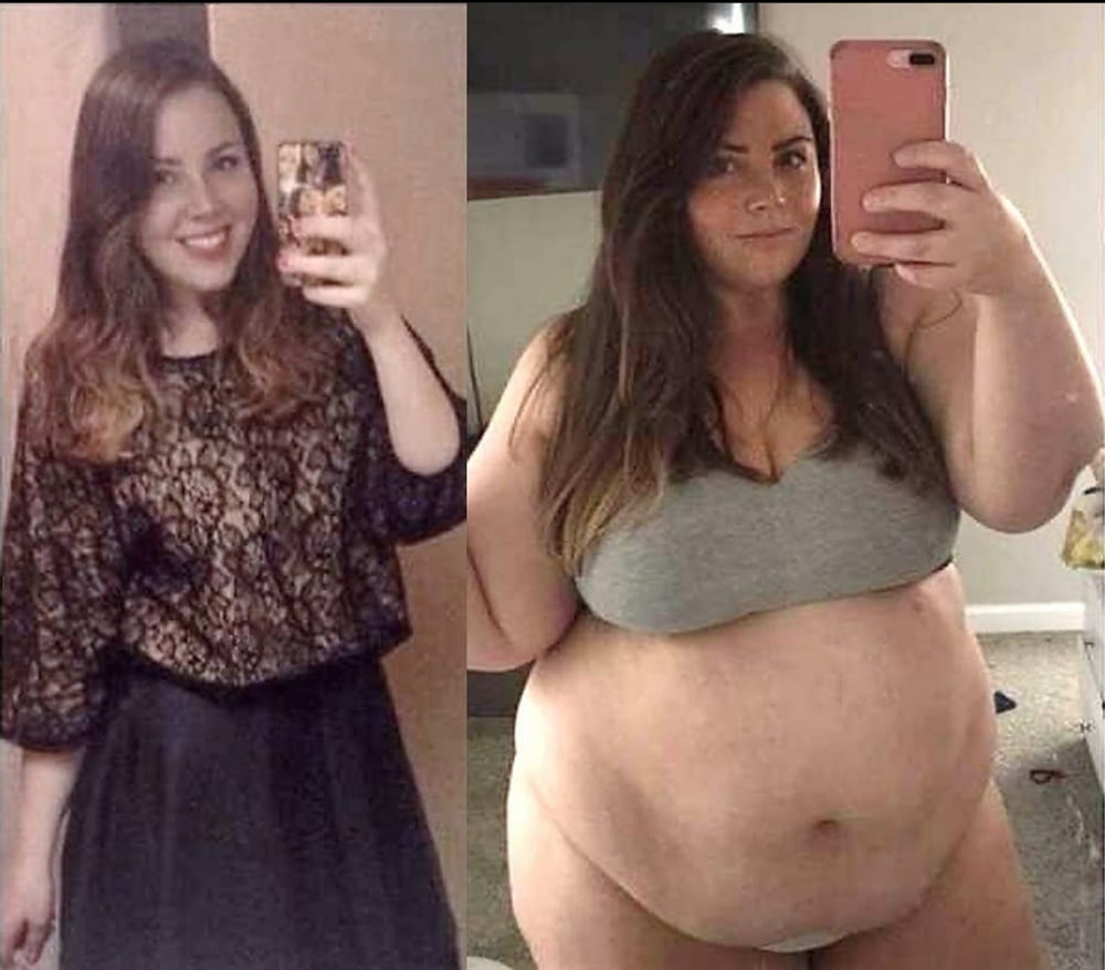 Weight Gain Before And After 6 - 30 Photos 