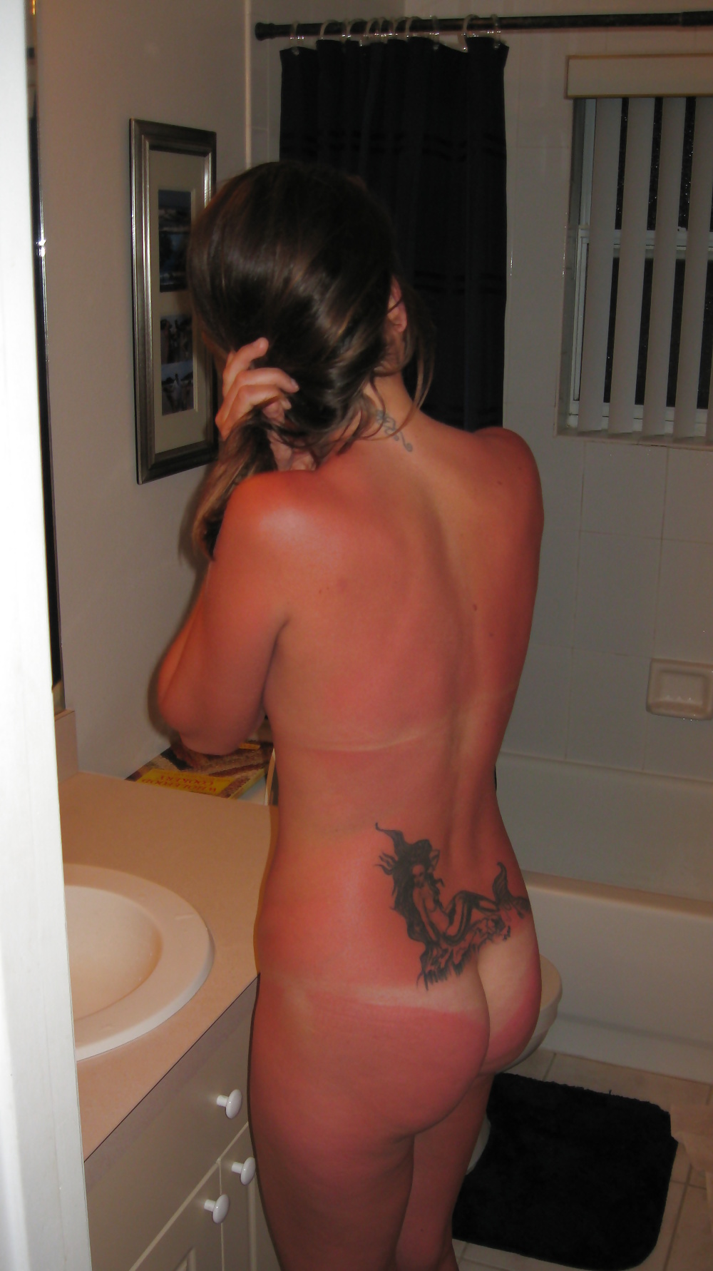 Porn Pics coup de soleil- sunburn