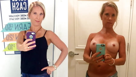 Before after boob milf