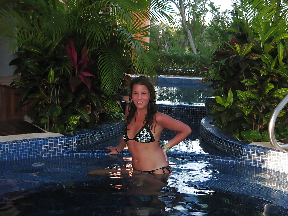 Porn Pics Maedelferien mit Sonnenbrand auf Kos