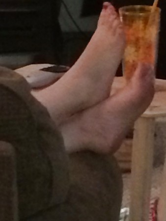 Wife's dirty feet from wearing flip flops all day