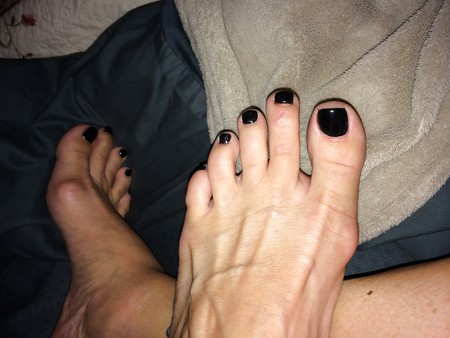 Wife's black toes