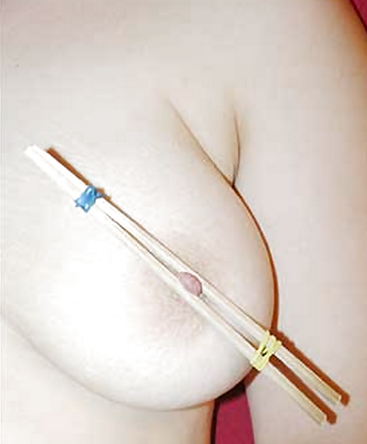 Chopstick nipple clamp - 🧡 After Nipple Clamps. 