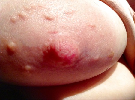 Close up of my wife's nipple