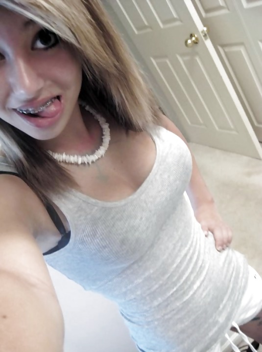 Porn Pics Vote for braces and tits amateur teens